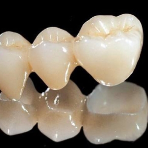 ǻÏ(f)Ϙ֬a(chn)ƷעԆԪ(yng)΄